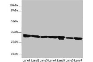 Western blot All lanes: ECHS1 antibody at 3. (ECHS1 antibody  (AA 28-290))