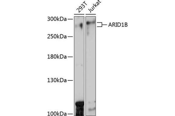 ARID1B 抗体  (AA 400-650)