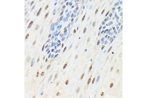 Immunohistochemistry of paraffin-embedded human esophageal using SLBP Rabbit pAb (ABIN7270590) at dilution of 1:100 (40x lens). (SLBP antibody)