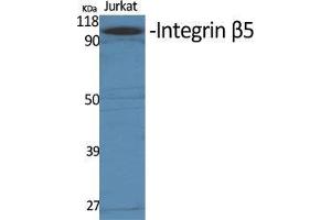 Western Blot (WB) analysis of specific cells using Integrin beta5 Polyclonal Antibody. (Integrin beta 5 antibody  (C-Term))