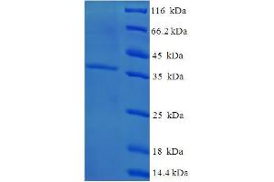 SDS-PAGE (SDS) image for Cysteine and Glycine-Rich Protein 3 (CSRP3) (AA 1-194), (full length) protein (His-SUMO Tag) (ABIN5709347)