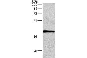 Western blot analysis of A549 cell, using WNT3A Polyclonal Antibody at dilution of 1:400 (WNT3A antibody)