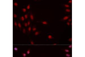 Immunofluorescence analysis of MCF-7 cells using Phospho-CHEK1(S317) Polyclonal Antibody (CHEK1 antibody  (pSer317))