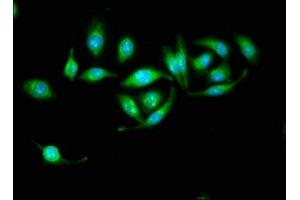 Immunofluorescence staining of A549 cells with ABIN7142296 at 1:133, counter-stained with DAPI. (HSD17B1 antibody  (AA 2-261))