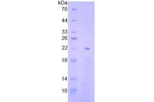 SDS-PAGE analysis of Human EGR1 Protein.