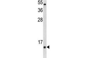 Western blot analysis of SOD1 antibody and Jurkat lysate. (SOD1 antibody  (AA 55-84))