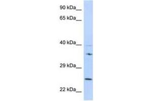 Image no. 1 for anti-Growth Factor Receptor-Bound Protein 2 (GRB2) (N-Term) antibody (ABIN6747987) (GRB2 antibody  (N-Term))