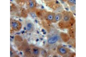 Used in DAB staining on fromalin fixed paraffin-embedded Liver tissue (GSTA3 antibody  (AA 1-221))