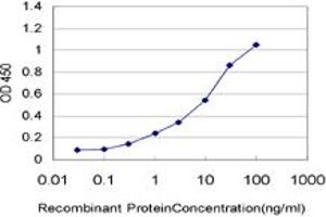 Detection limit for recombinant GST tagged PKD2 is approximately 0. (PKD2 antibody  (AA 261-360))