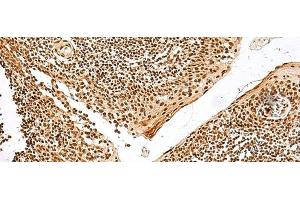 Immunohistochemistry of paraffin-embedded Human tonsil tissue using GRSF1 Polyclonal Antibody at dilution of 1:30(x200) (GRSF1 antibody)