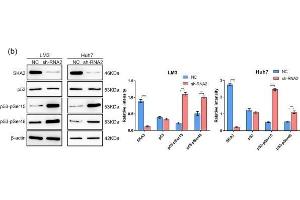 Depletion of SKA3 promotes apoptosis in HCC cells.