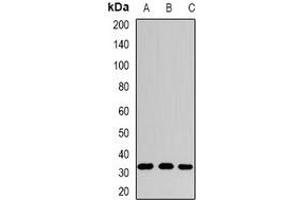 Western blot analysis of SPDSY expression in HepG2 (A), mouse stomach (B), rat liver (C) whole cell lysates.
