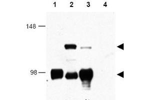 Image no. 1 for anti-CREB Regulated Transcription Coactivator 1 (CRTC1) (AA 19-34) antibody (ABIN401346) (CRTC1 antibody  (AA 19-34))