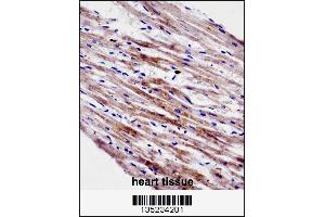 CTF1 Antibody immunohistochemistry analysis in formalin fixed and paraffin embedded human heart tissue followed by peroxidase conjugation of the secondary antibody and DAB staining. (Cardiotrophin 1 antibody  (C-Term))