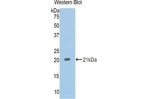 Detection of Recombinant CBG, Human using Polyclonal Antibody to Corticosteroid Binding Globulin (CBG) (SERPINA6 antibody  (AA 218-378))