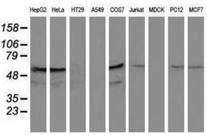 Image no. 1 for anti-Katanin P60 Subunit A-Like 1 (KATNAL1) antibody (ABIN1498985) (KATNAL1 antibody)