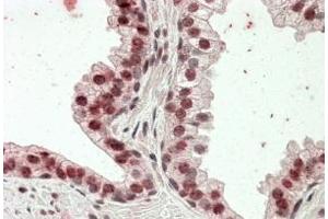 Immunohistochemistry (3. (Homeobox D13 antibody  (Internal Region))