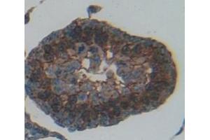 Figure. (Mps1 antibody  (AA 570-787))