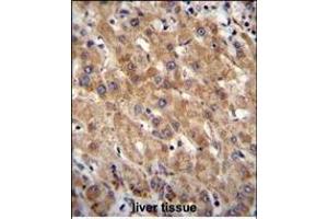 MIA40 Antibody (C-term) (ABIN655475 and ABIN2844998) immunohistochemistry analysis in formalin fixed and paraffin embedded human liver tissue followed by peroxidase conjugation of the secondary antibody and DAB staining. (CHCHD4 antibody  (C-Term))