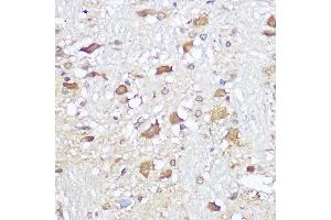 Immunohistochemistry of paraffin-embedded rat brain using Mu Opioid Receptor(MOR) Rabbit pAb (ABIN7269101) at dilution of 1:100 (40x lens). (Mu Opioid Receptor 1 antibody  (C-Term))