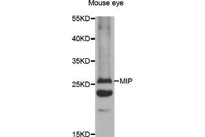 Western blot analysis of extracts of mouse eye, using MIP antibody (ABIN5971491) at 1:400 dilution. (MIP antibody)