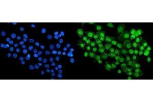 IF analysis of RBM47 using anti-RBM47 antibody (ABIN7602242). (RBM47 antibody  (AA 66-317))