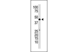 The anti-GDF3 N-term Pab (ABIN388818 and ABIN2839136) is used in Western blot to detect GDF3 in mouse kidney tissue lysate. (GDF3 antibody  (N-Term))