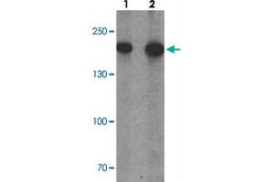 Western blot analysis of PHLPP1 in SW480 cell lysate with PHLPP1 polyclonal antibody  at (1) 1 and (2) 2 ug/mL.