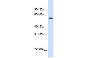 Catalase antibody used at 1 ug/ml to detect target protein. (Catalase antibody  (Middle Region))