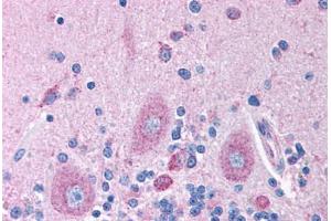 Immunohistochemistry (Paraffin-embedded Sections) (IHC (p)) image for anti-gamma-aminobutyric Acid (GABA) A Receptor, beta 2 (GABRB2) (AA 143-192) antibody (ABIN6736385)