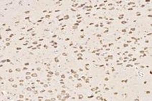 Immunohistochemistry analysis of paraffin-embedded rat substantia nigra using ST8SiaIII (ABIN7075721) at dilution of 1: 4000 (ST8SIA3 antibody)