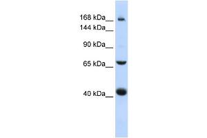 WB Suggested Anti-ABCC9 Antibody Titration:  0. (ABCC9 antibody  (Middle Region))