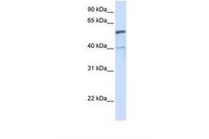 Image no. 1 for anti-UDP Glucuronosyltransferase 1 Family, Polypeptide A6 (UGT1A6) (C-Term) antibody (ABIN6737983) (UGT1A6 antibody  (C-Term))