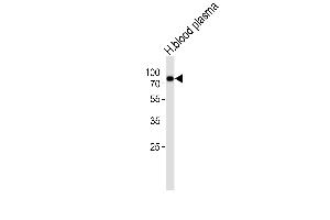 Western blot analysis of lysate from human blood plasma tissue lysate,using THRB Antibody (, Cleaved-Arg327)(ABIN6242006). (THRB antibody  (Cleaved-Arg327))
