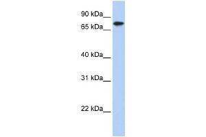 WB Suggested Anti-KLHL23 Antibody Titration: 0. (KLHL23 antibody  (Middle Region))