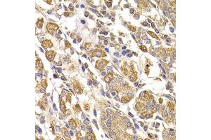 Immunohistochemistry of paraffin-embedded human stomach using METTL7B antibody (ABIN5974333) at dilution of 1/100 (40x lens). (METTL7B antibody)