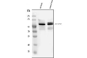 Western blot analysis of Ataxin 1 using anti-Ataxin 1 antibody (ABIN3043506). (Ataxin 1 antibody  (C-Term))