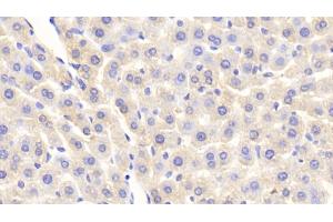 Immunohistochemistry (IHC) image for anti-Amyloid P Component, Serum (APCS) (AA 22-222) antibody (ABIN7433756)