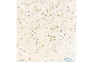 Immunohistochemistry analysis of paraffin embedded mouse brain using KCNIP3 (ABIN7073771) at dilution of 1: 2000 (DREAM antibody)
