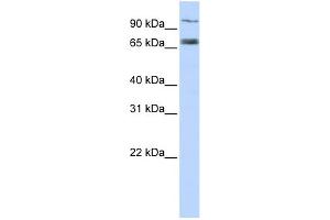 WB Suggested Anti-TAP1 Antibody Titration:  0. (TAP1 antibody  (Middle Region))
