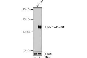 Western blot analysis of extracts of NIH/3T3 cells, using Phospho-Tyk2-Y1054/1055 Rabbit pAb (ABIN6135332, ABIN6136278, ABIN6136279 and ABIN6225571) at 1:1000 dilution.