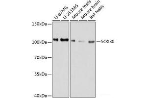 Western blot analysis of extracts of various cell lines using SOX30 Polyclonal Antibody at dilution of 1:1000. (SOX30 antibody)