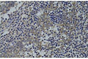 Immunohistochemistry of paraffin-embedded Human tonsil using GNA15 Polyclonal Antibody at dilution of 1:100 (40x lens). (GNA15 antibody)