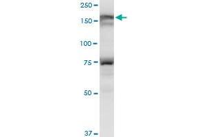 LMTK3 antibody  (AA 1151-1250)