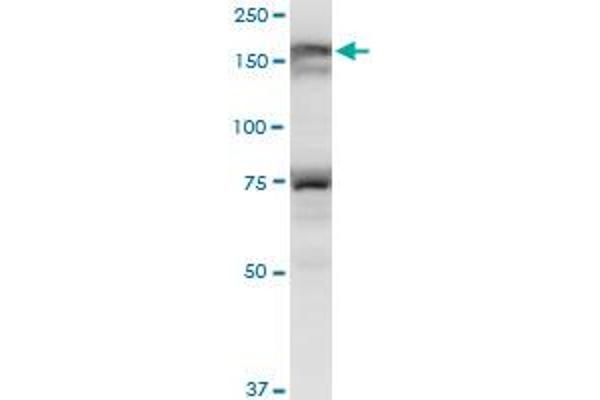 LMTK3 antibody  (AA 1151-1250)