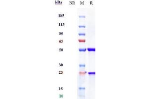 Anti-IL-23a Reference Antibody (risankizumab) on SDS-PAGE under reducing (R) condition. (Recombinant IL23A (Risankizumab Biosimilar) antibody)