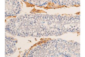 Immunohistochemistry (IHC) image for anti-Heat Shock Protein, alpha-Crystallin-Related, B6 (HSPB6) (pSer16) antibody (ABIN6256161)