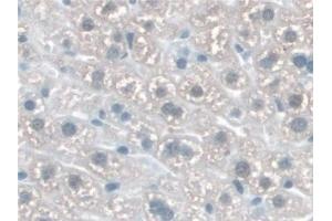 Detection of KATNA1 in Mouse Liver Tissue using Polyclonal Antibody to Katanin P60 Subunit A 1 (KATNA1) (KATNA1 antibody  (AA 260-491))
