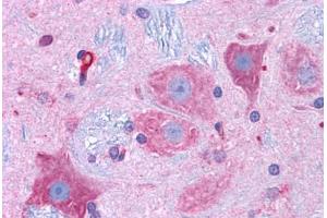 Immunohistochemistry (Formalin-fixed Paraffin-embedded Sections) (IHC (fp)) image for anti-Calcium Channel, Voltage-Dependent, L Type, alpha 1D Subunit (CACNA1D) (AA 859-875) antibody (ABIN604999)