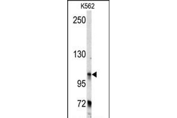 BICD2 Antikörper  (C-Term)